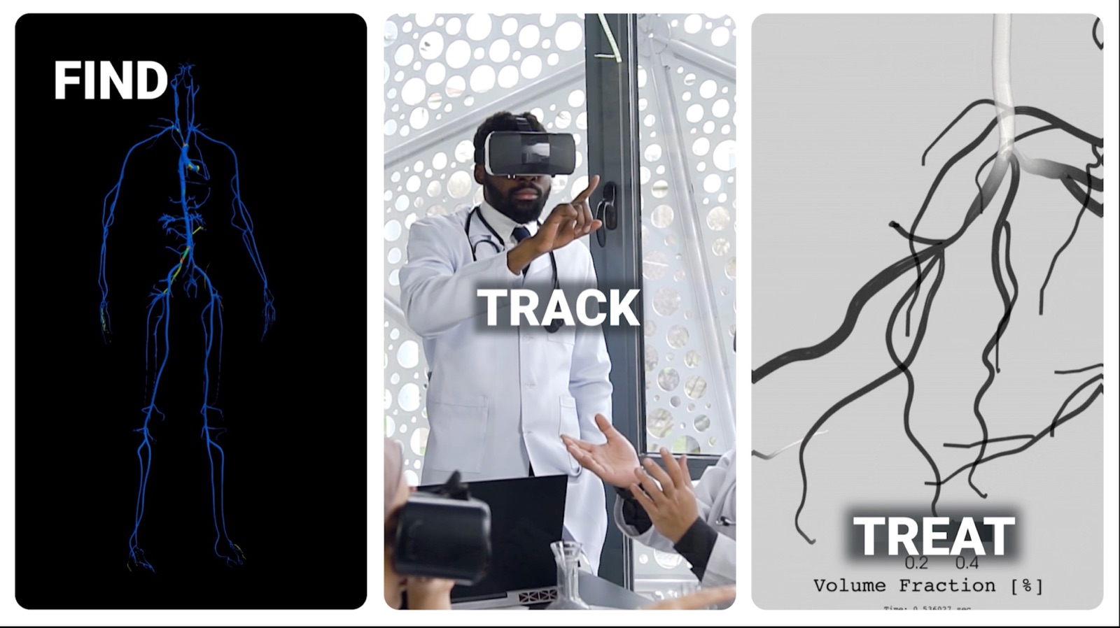 Three-panel graphic labeled Find, Track, and Treat: a glowing map of the body's blood vessels, a doctor using a VR headset, and a rendered model of branching vessels